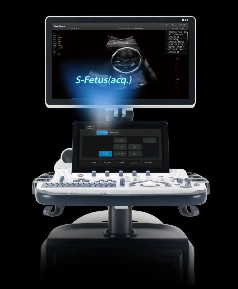 
                  
                    SonoScape S60 Trolley Color Doppler
                  
                