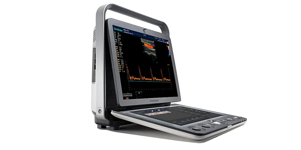 SonoScape S9 Color Doppler Ultrasound