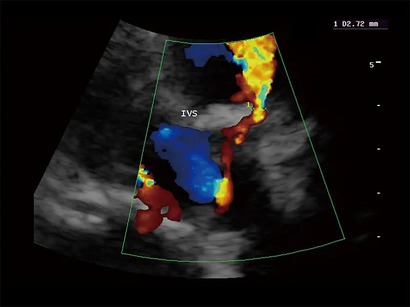 
                  
                    SonoScape S9 Color Doppler Ultrasound
                  
                