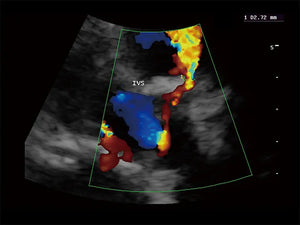 
                  
                    SonoScape S9 Color Doppler Ultrasound
                  
                