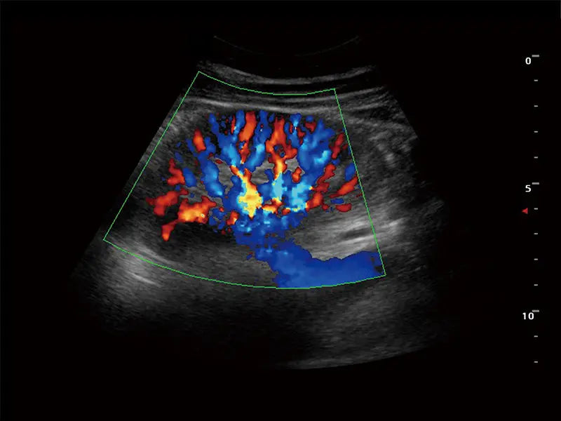 
                  
                    SonoScape S9 Color Doppler Ultrasound 
                  
                