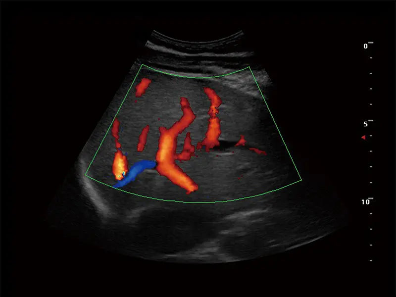 
                  
                    SonoScape S9 Color Doppler Ultrasound
                  
                