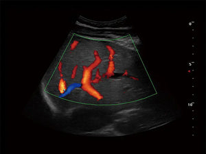 
                  
                    SonoScape S9 Color Doppler Ultrasound
                  
                