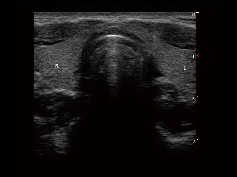 
                  
                    SonoScape S9 Color Doppler Ultrasound
                  
                