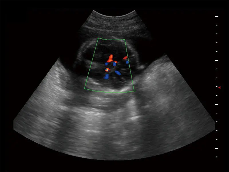 
                  
                    SonoScape S9 Color Doppler Ultrasound
                  
                