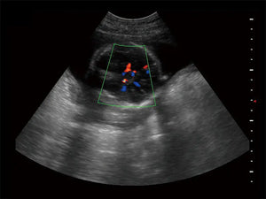 
                  
                    SonoScape S9 Color Doppler Ultrasound
                  
                