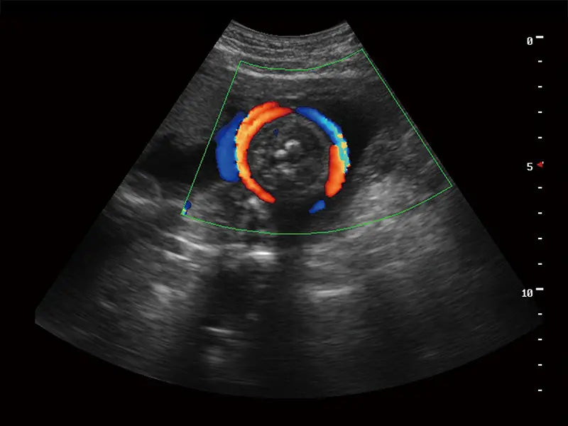 
                  
                    SonoScape S9 Color Doppler Ultrasound
                  
                