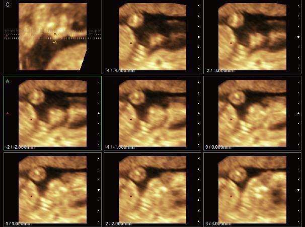 
                  
                    Chison Sonobook 9 Color Doppler Crystal Clear, Detailed Images | KeeboMed
                  
                