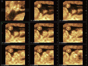 
                  
                    Chison Sonobook 9 Color Doppler Crystal Clear, Detailed Images | KeeboMed
                  
                