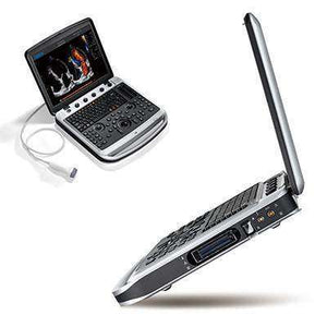
                  
                    Chison Sonobook 9 Color Doppler Slim Design | KeeboMed
                  
                