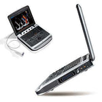 Chison Sonobook 9Vet Laptop Ultrasound Machine | KeeboMed