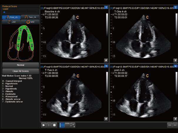 
                  
                    Chison Sonobook 9 Color Doppler Crystal Clear, Detailed Images | KeeboMed
                  
                
