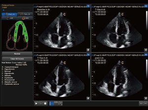 
                  
                    Chison Sonobook 9 Color Doppler Crystal Clear, Detailed Images | KeeboMed
                  
                