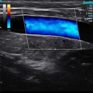 
                  
                    Chison SonoEye P2 Linear Array Smartphone Mobile Ultrasound | KeeboMed
                  
                