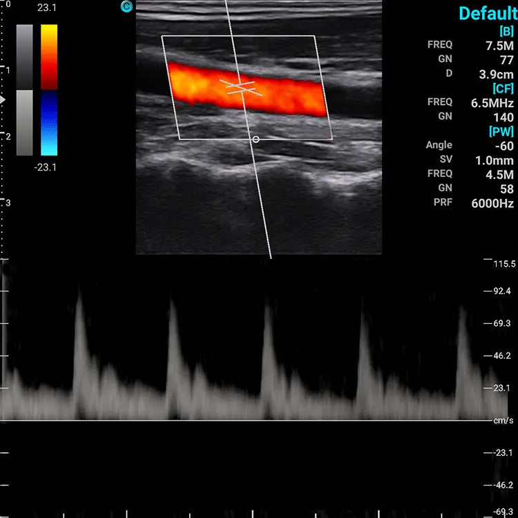 
                  
                    Chison SonoEye P2 Linear Array Smartphone Mobile Ultrasound | KeeboMed
                  
                