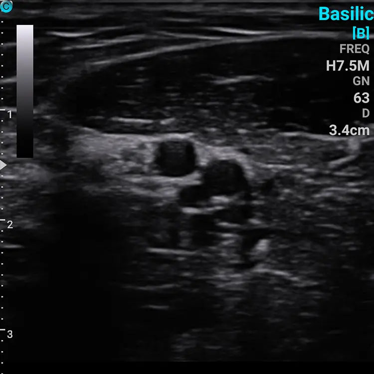 
                  
                    Chison SonoEye P2 Linear Array Smartphone Mobile Ultrasound | KeeboMed
                  
                