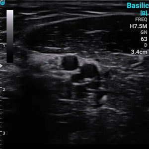 
                  
                    Chison SonoEye P2 Linear Array Smartphone Mobile Ultrasound | KeeboMed
                  
                