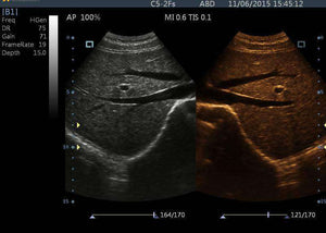 
                  
                    KEEBOTOUCH 30V Veterinary Touchscreen Ultrasound | KeeboMed
                  
                