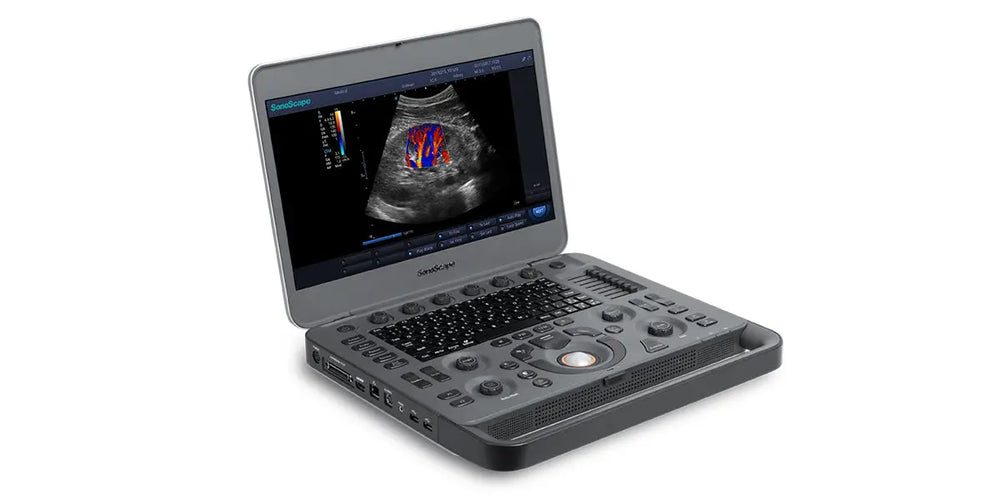 SonoScape X3 Portable Color Doppler Ultrasound