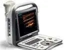 
                  
                    SonoScape A6 Demo Ultrasound Great Price | KeeboMed
                  
                