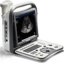 
                  
                    SonoScape A6 Demo Ultrasound Great Price | KeeboMed
                  
                