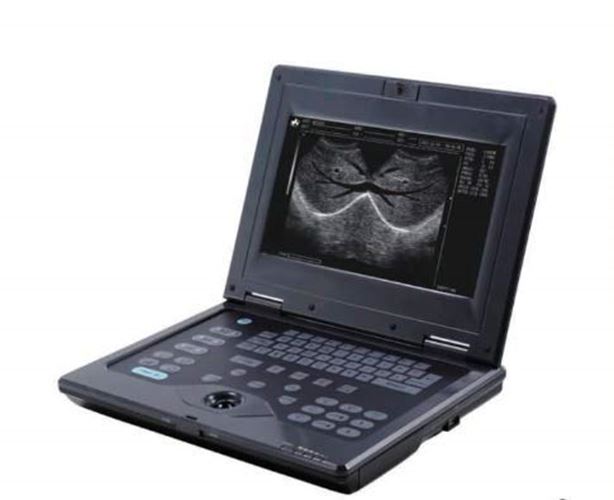 
                  
                    keebomed WED-2018V Veterinary Ultrasound for Large Animals with Rectal Probe
                  
                