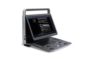 
                  
                    SonoScape A6V Expert -E1V on Sale!
                  
                