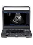 SonoScape A6V Expert - E1V Demo Model B/W Ultrasound | KeeboMed