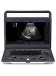 
                  
                    SonoScape A6V Expert - E1V Demo Model B/W Ultrasound | KeeboMed
                  
                