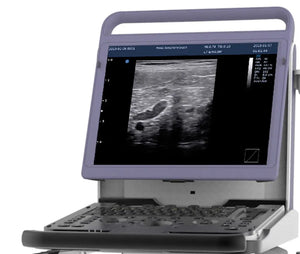 
                  
                    EBit10 Black & White Ultrasound | KeeboMed
                  
                