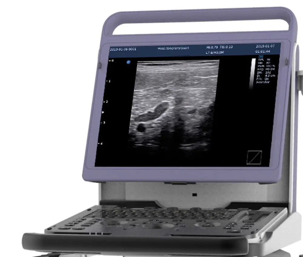 
                  
                    KeeboMed E10V Animal Ultrasound Machine
                  
                