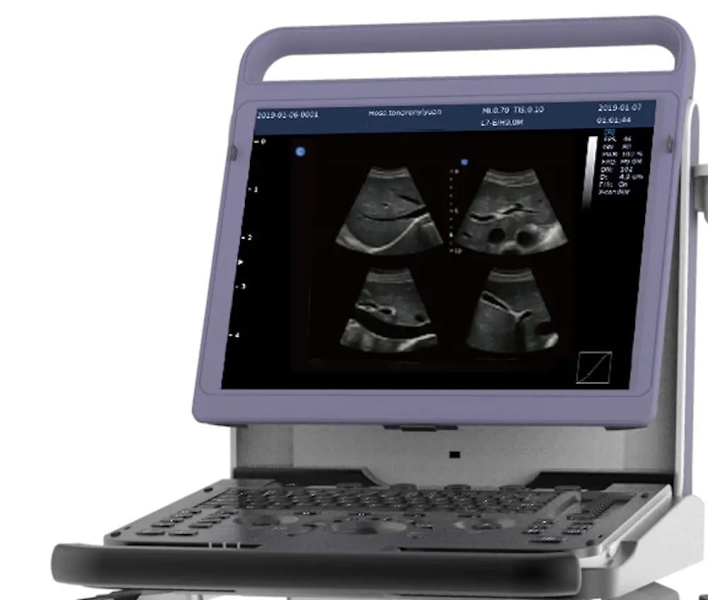 
                  
                    KeeboMed E10V Animal Ultrasound Machine
                  
                