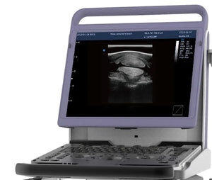 
                  
                    EBit10 Black & White Ultrasound | KeeboMed
                  
                