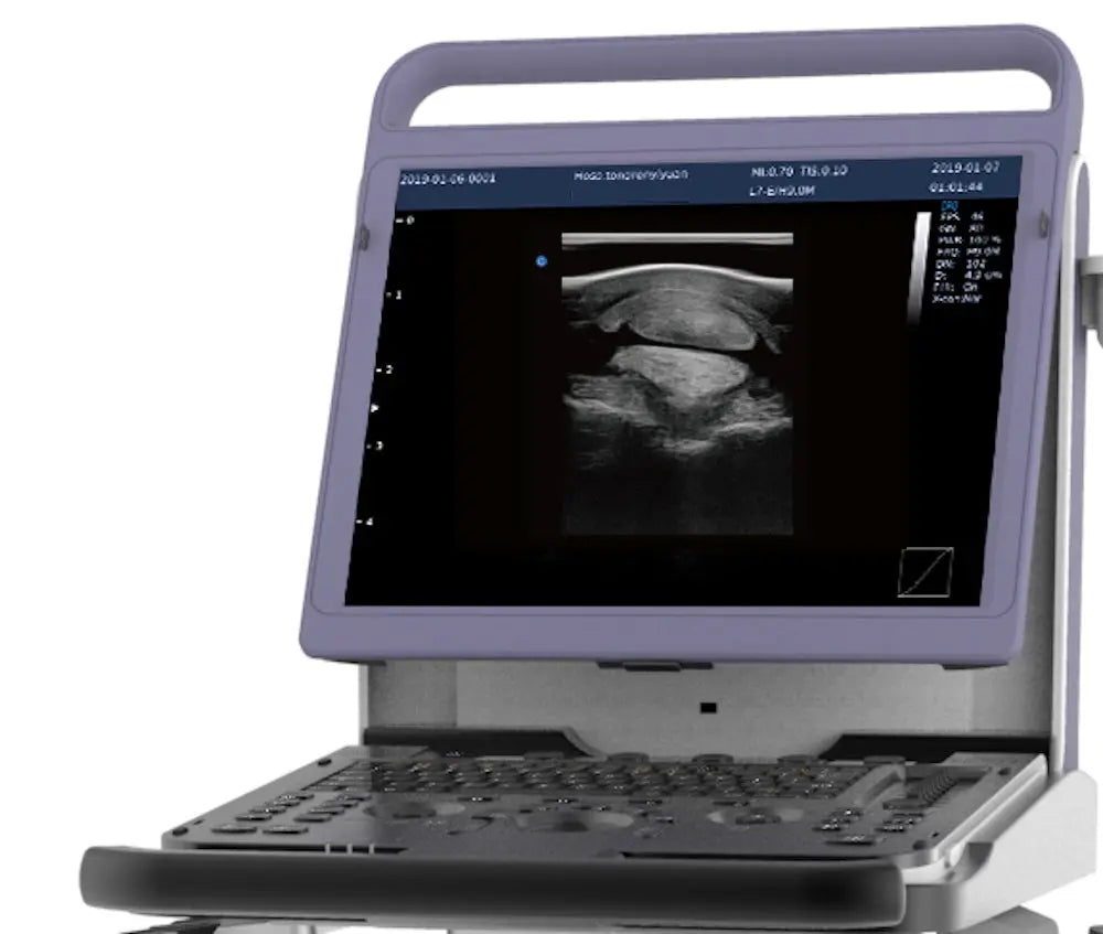 
                  
                    KeeboMed E10V Animal Ultrasound Machine
                  
                