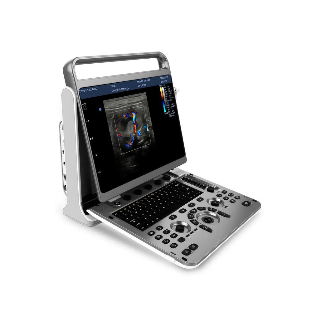 Chison EBit 50 Color Doppler Ultrasound Machine For Human Medicine | KeeboMed