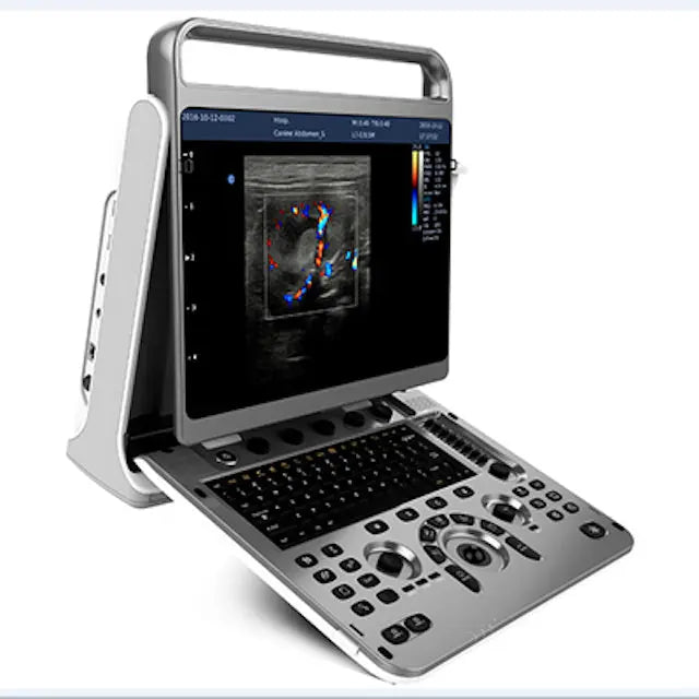 
                  
                    Chison EBit 30 4D Color Doppler Ultrasound Machine For Human Medicine | KeeboMed
                  
                