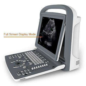 
                  
                    Adjustable Angled Screen | Chison ECO2 Ultrasound Machine
                  
                