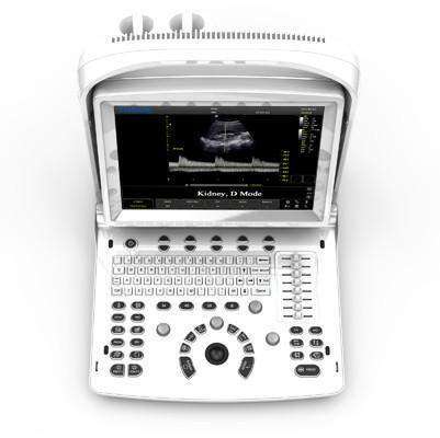 
                  
                    Chison ECO3 EXPERT Ultrasound | KeeboMed
                  
                