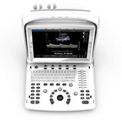 
                  
                    Demo Chison ECO3 EXPERT
                  
                