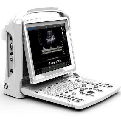 Chison ECO3 EXPERT Ultrasound | KeeboMed