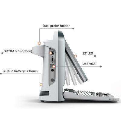 
                  
                    Chison ECO5 Ultrasound Well Designed For Easy Use
                  
                