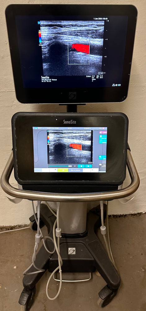 
                  
                    Sonosite X-Porte Ultrasound without probes manufactured 2021
                  
                
