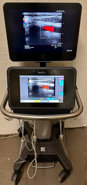 
                  
                    Sonosite X-Porte Ultrasound without probes manufactured 2021
                  
                