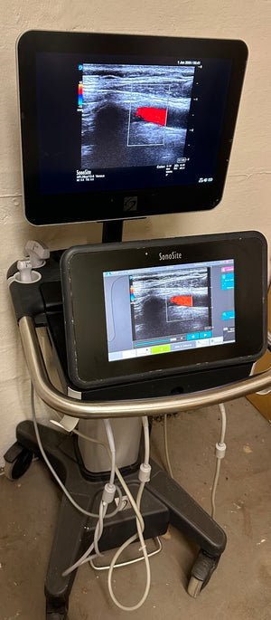 
                  
                    Sonosite X-Porte Ultrasound without probes manufactured 2021
                  
                