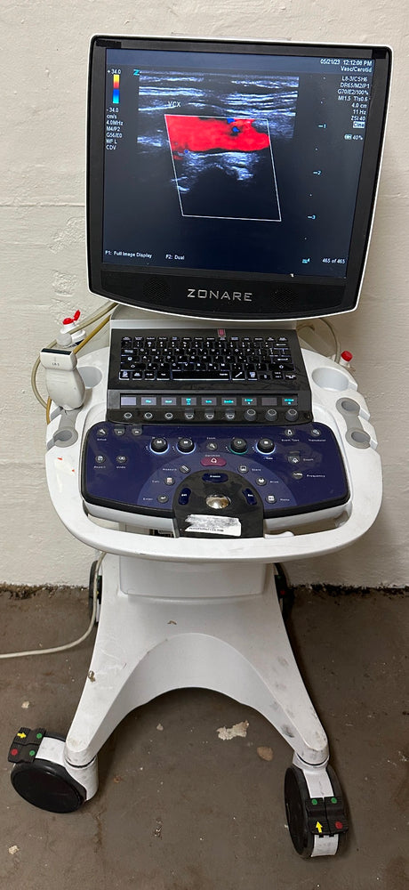 ZONARE ZS 3 Ultrasound Scanner Machine  2014