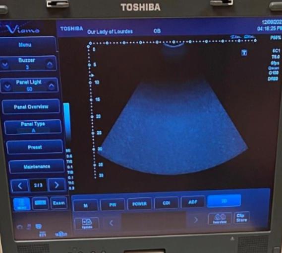 
                  
                    Convex, Abdominal Ultrasund Probe,Transducer TOSHIBA PVT-375ST For Viamo
                  
                