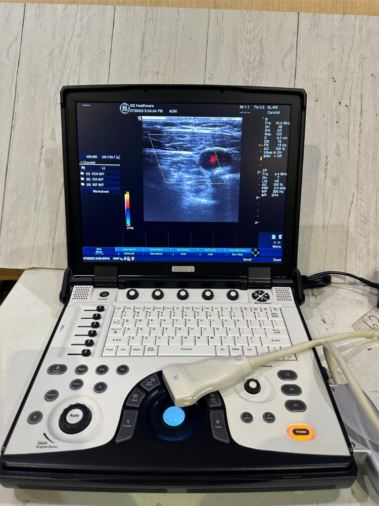 BT12 GE LOGIQ E Next Ge Ultrasound 2013, Vascular,OBGYN, MSK