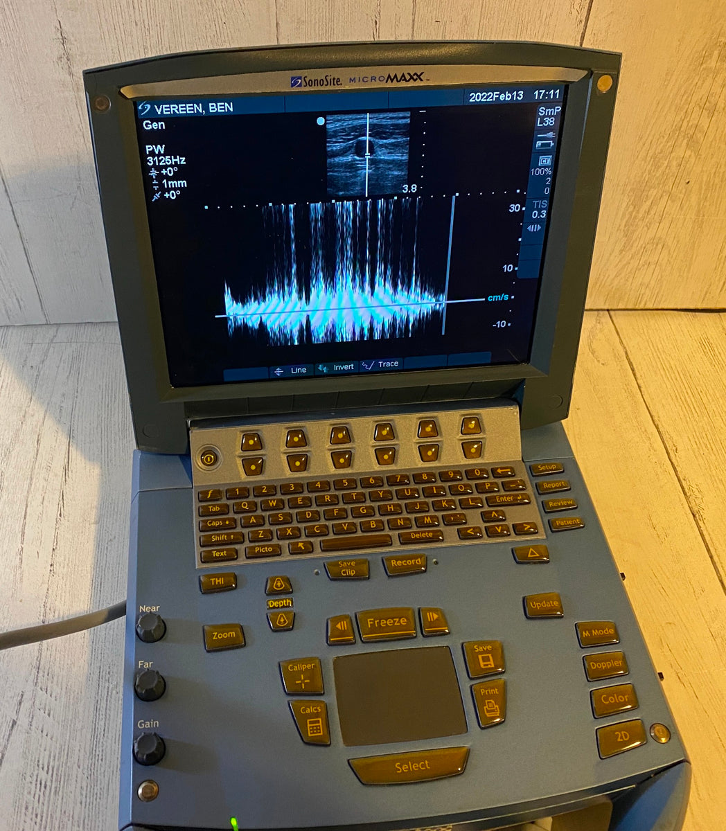 Micromaxx Sonosite MicroMaxx Portable Ultrasound 2008 - Main unit – KeeboMed