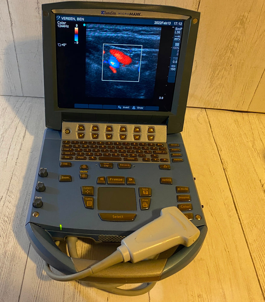 Micromaxx Sonosite MicroMaxx Portable Ultrasound 2008 - Main unit – KeeboMed