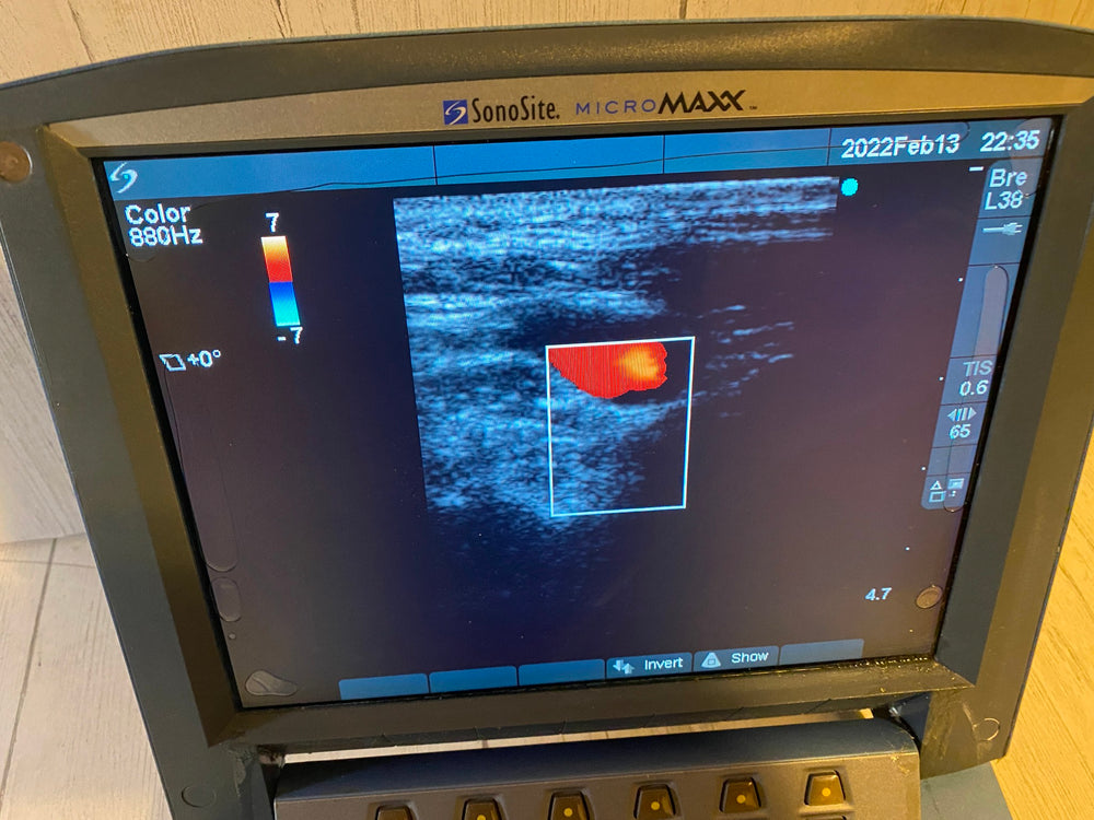 
                  
                    Sonosite MicroMaxx Portable Ultrasound 2007- Main unit
                  
                